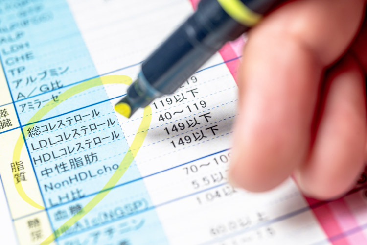 脂質異常症イメージ画像